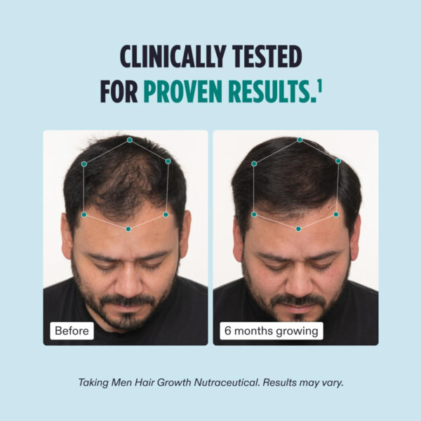 Healthy Space，Men's Hair Growth Supplements, Clinically Tested for Visibly Thicker Hair and Scalp Coverage